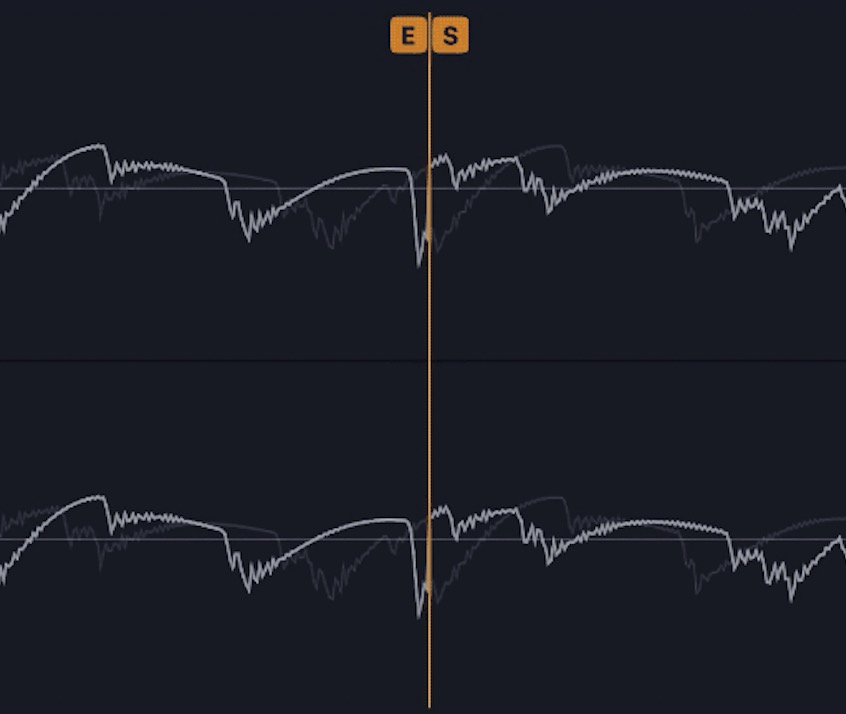 Edit Loop view: the loop end joined to the loop start